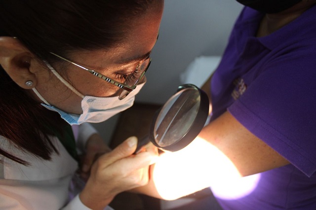 Identificar melanoma lentiginoso acral de forma oportuna permite tratamiento: IMSS Guerrero