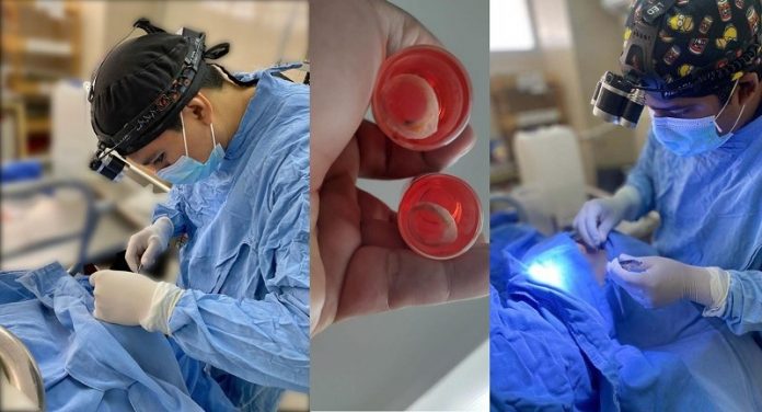 Procuran médicos del IMSS Guerrero dos pares de córneas; devuelven vista a cuatro personas. Para ser donador voluntario de órganos y tejidos, puede consultar la página de internet del Centro Nacional de Trasplantes