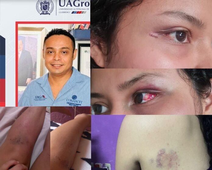 Una adolescente de 15 años denunció haber sido agredida por su padre en Acapulco. El caso ocurre días antes del Día Internacional de la Mujer y reabre el debate sobre violencia familiar en México.